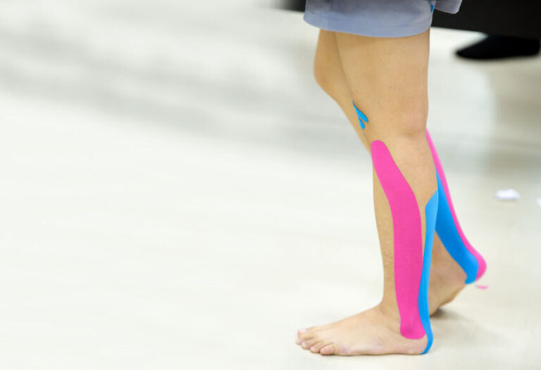 What is Kinesio Tape?