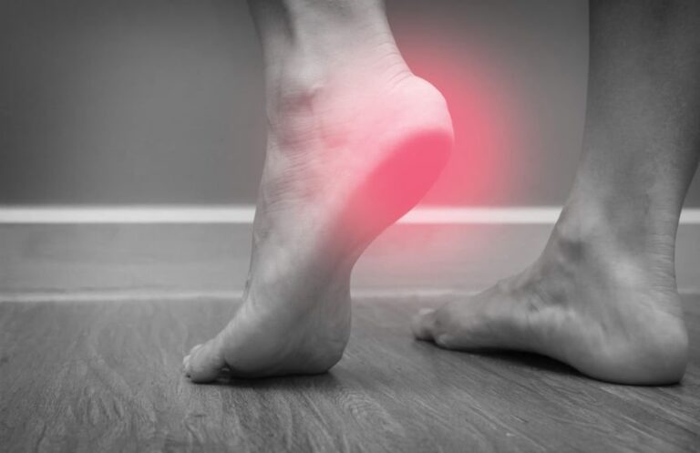 What is a Plantar Fascia Rupture?