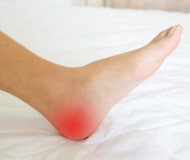 Bottom of heel is red in pain heel pain