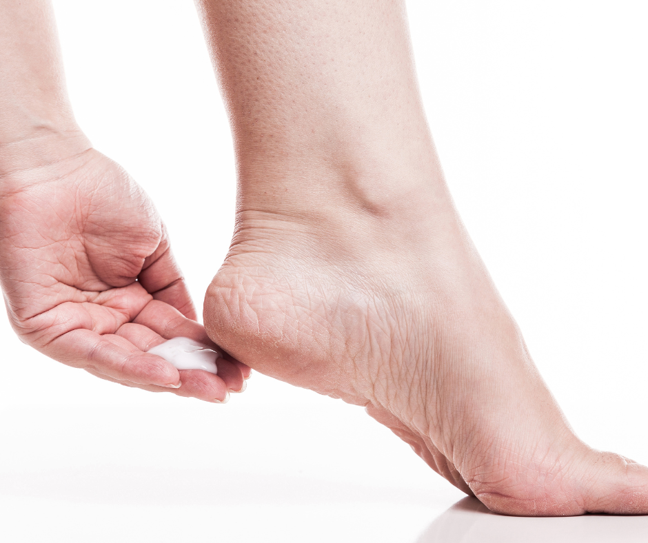 dry cracked foot hand putting lotion on